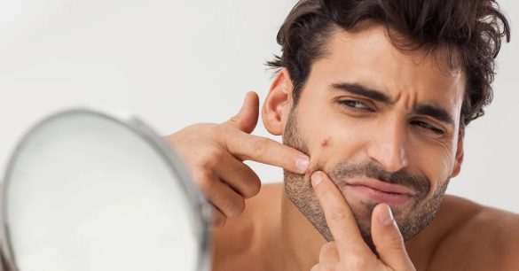 جوش و التهاب بعد از اصلاح