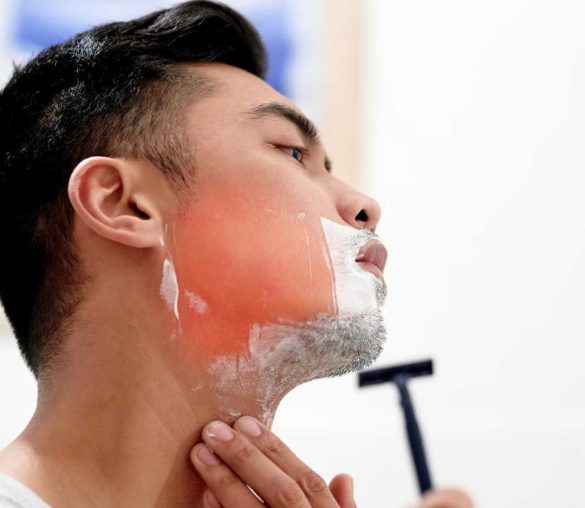 اصلاح موی زائد