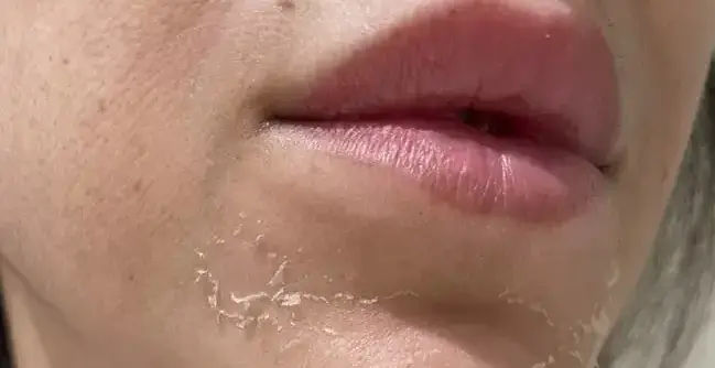 اصلاح موی زائد