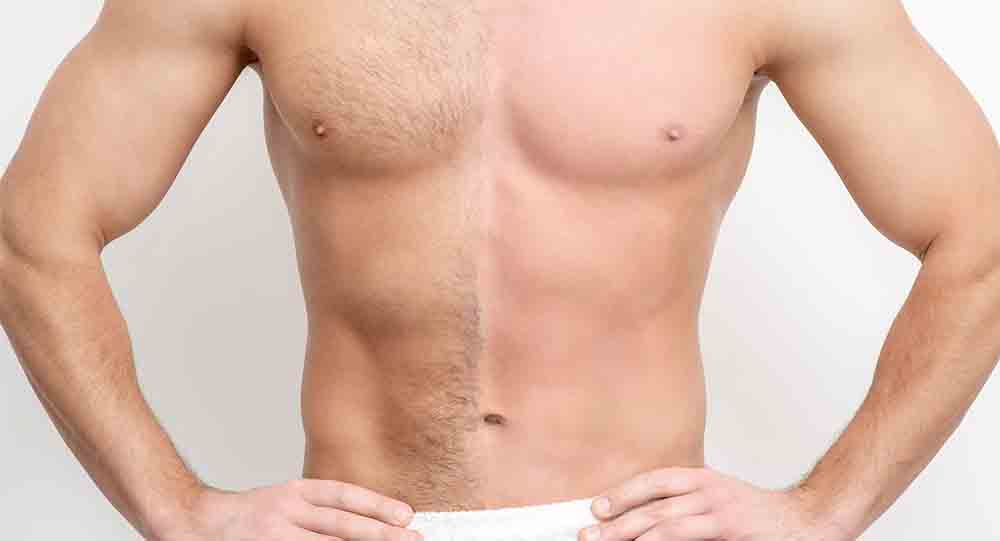 حذف موهای زائد