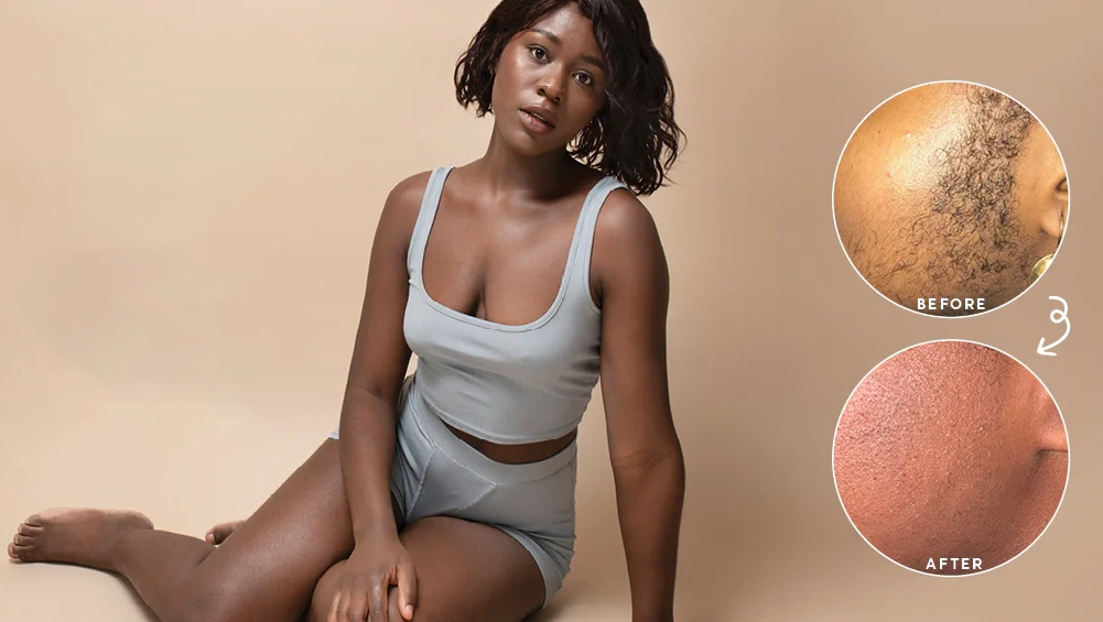 اصلاح موهای زائد