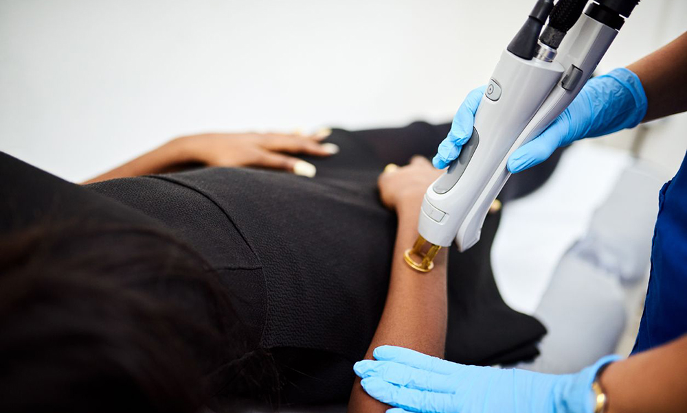 اصلاح موهای زائد