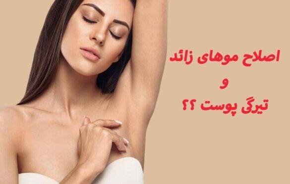 اصلاح موهای زائد