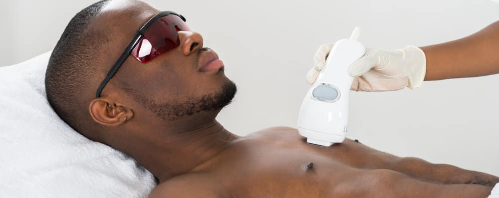 لیزر موهای زائد