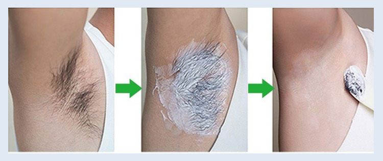 اصلاح موهای زائد