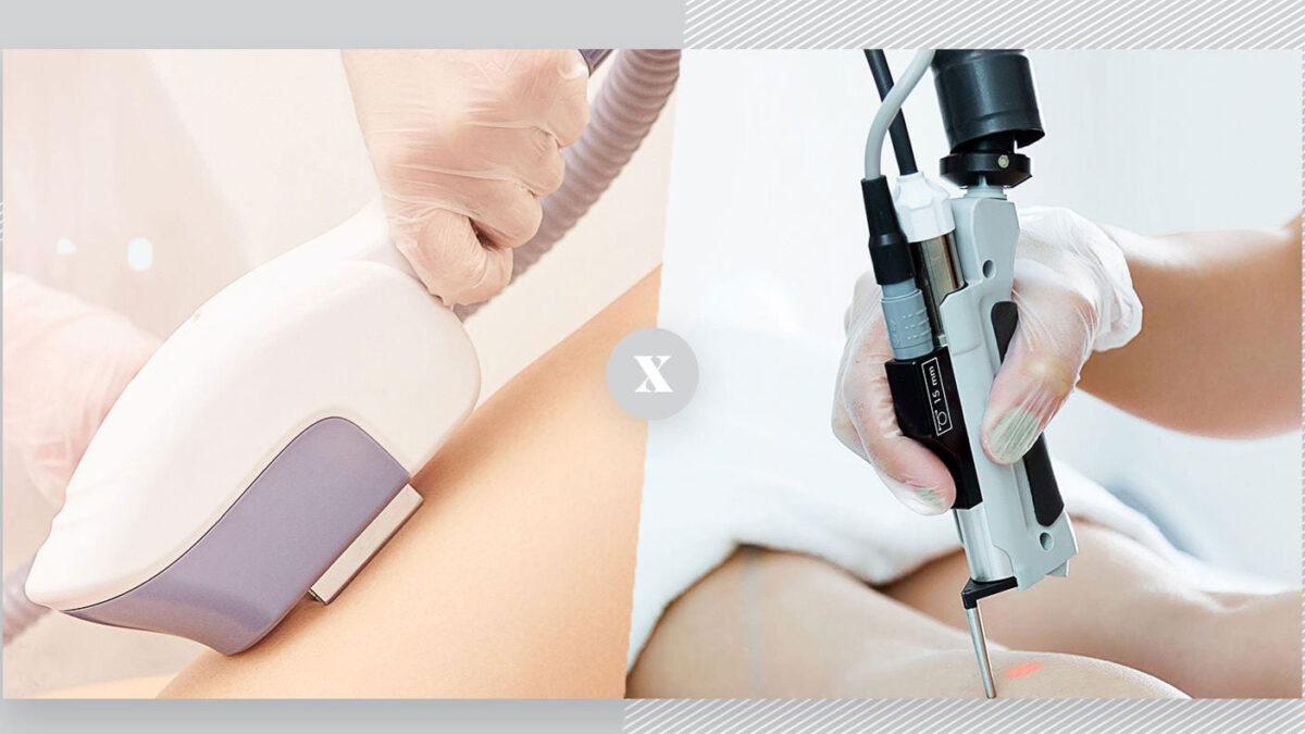 لیزر یا IPL؟ تفاوت‌ها، مزایا و انتخاب بهترین روش