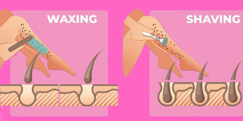 اصلاح موهای زائد