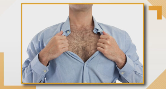 حذف موهای زائد