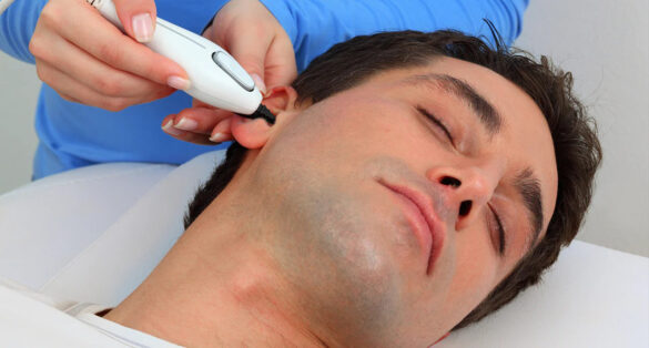 اصلاح موهای زائد