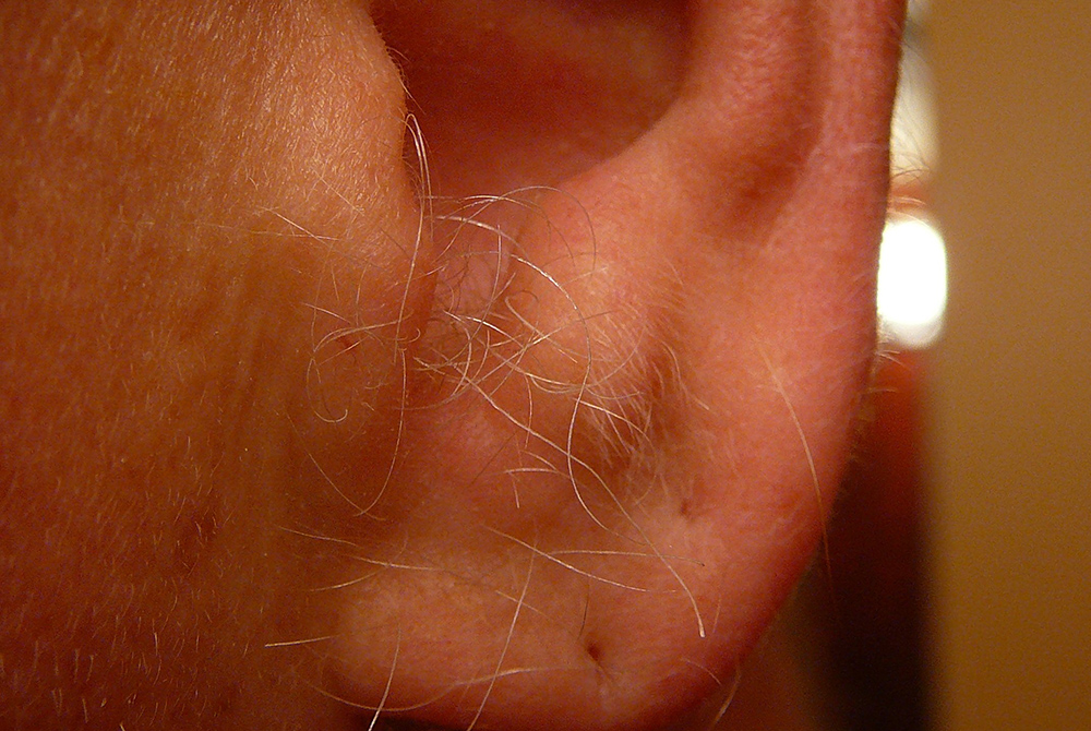 اصلاح موهای زائد